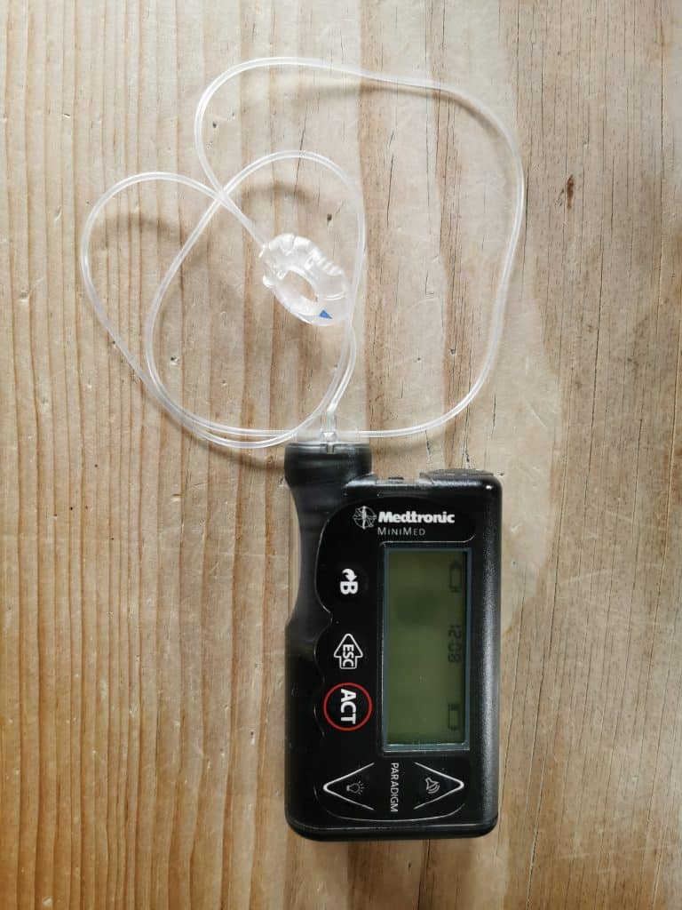 A typical insulin pump